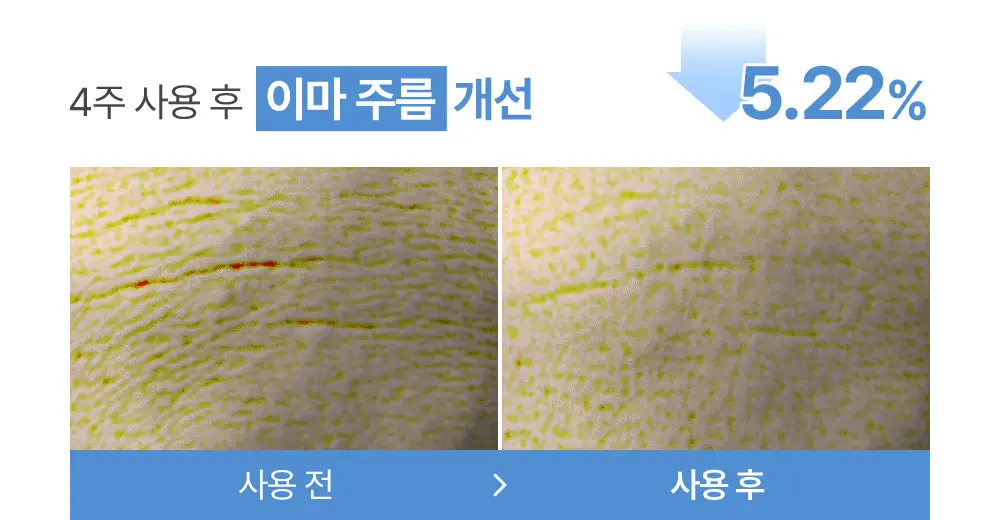 [NEW] 정샘물 에센셜 물 링클 리프팅 듀오 패치 5매 상세페이지 15